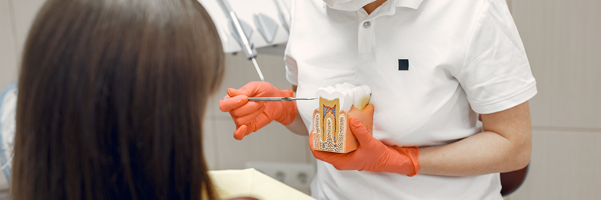 Cavity Fillings Langford