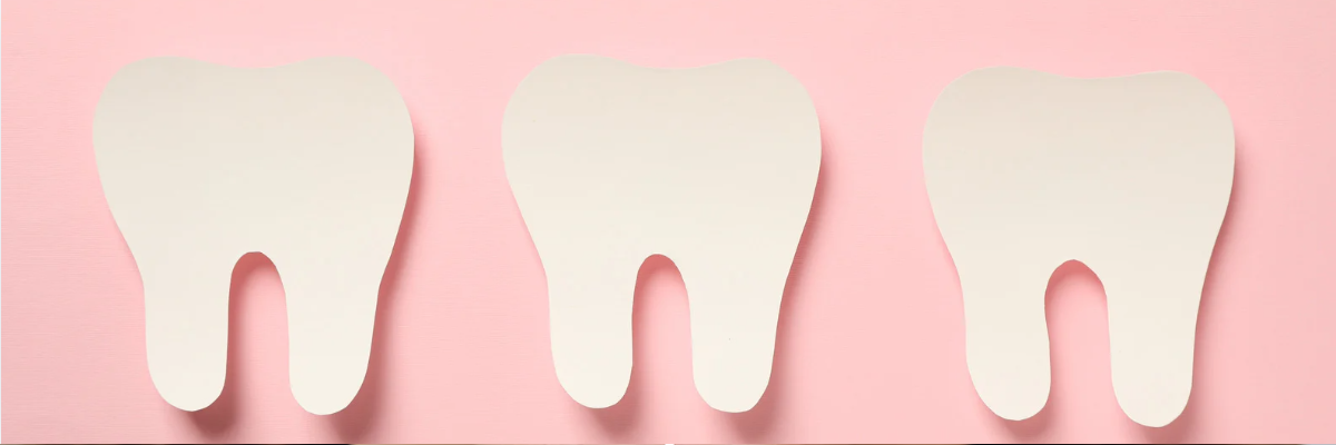 Veneers Langford