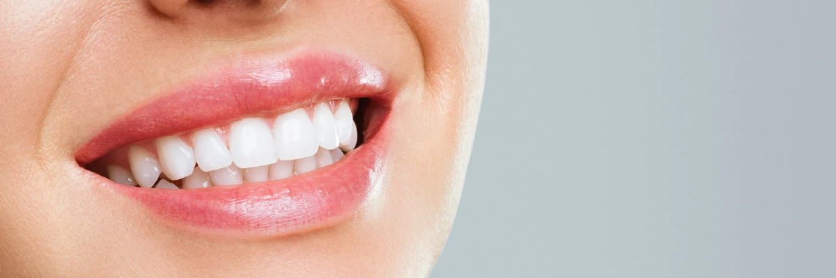 Teeth Cleaning Langford